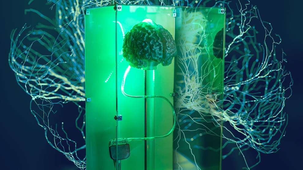 Science Corp. залучила $230 млн, готуючи виведення нейроімпланта PRIMA на ринок